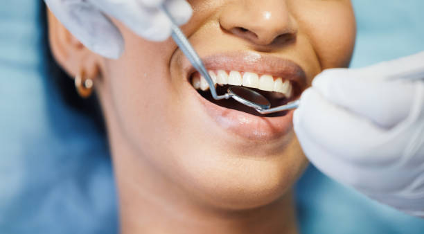 Best Dentist for Tooth Abscess  in Elliston, VA